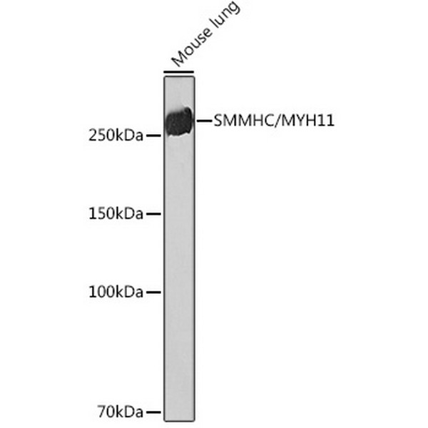SMMHC/MYH11 Rabbit mAb (A4064) SMMHC/MYH11 Rabbit mAb (A4064)