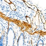 Abclonal SMMHC/MYH11 Rabbit mAb (Catalog Number: A4064)