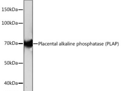 Placental alkaline phosphatase (PLAP) Rabbit mAb (A4304)
