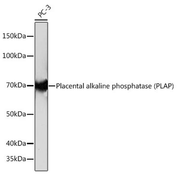 Placental alkaline phosphatase (PLAP) Rabbit mAb (A4304) | Abclonal ...