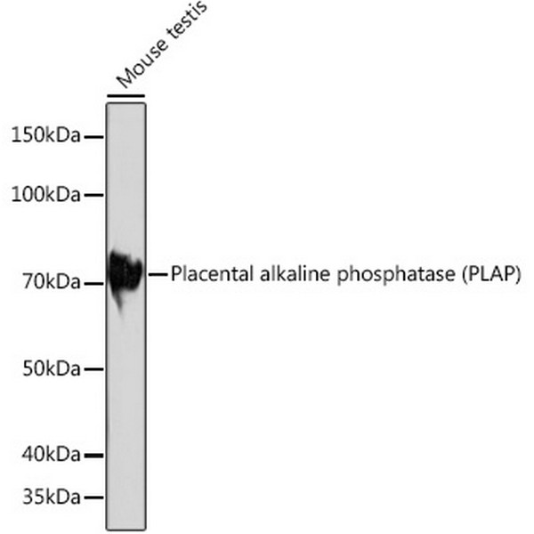 A4304: Placental alkaline phosphatase (PLAP) Rabbit mAb