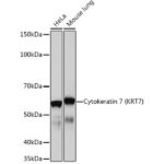 Cytokeratin 7 (CK7) Rabbit mAb (A4357)