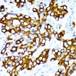 Cytokeratin 7 (CK7) Rabbit mAb (Catalog Number: A4357) Abclonal