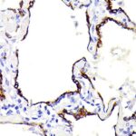 Abclonal Cytokeratin 7 (CK7) Rabbit mAb (Catalog Number: A4357)