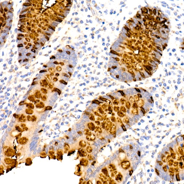 TFF3 Rabbit mAb (A4592) TFF3 Rabbit mAb (A4592)