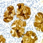 TFF3 Rabbit mAb (Catalog Number: A4592) Abclonal