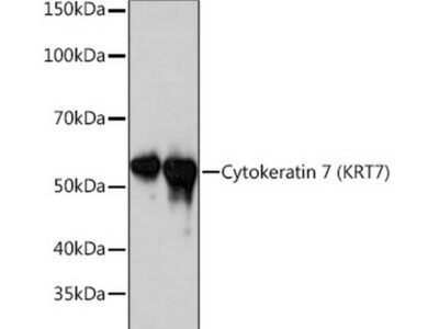 Cytokeratin 7 (KRT7) Rabbit mAb (A4765)