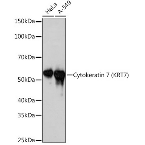 Cytokeratin 7 (KRT7) Rabbit mAb (A4765) Cytokeratin 7 (KRT7) Rabbit mAb (A4765)