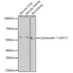 A4765: Cytokeratin 7 (KRT7) Rabbit mAb
