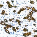 Cytokeratin 7 (KRT7) Rabbit mAb (Catalog Number: A4765) Abclonal