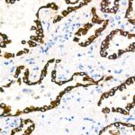 Abclonal Cytokeratin 7 (KRT7) Rabbit mAb (Catalog Number: A4765)