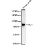 [KO Validated] MLH1 Rabbit mAb (A4858)