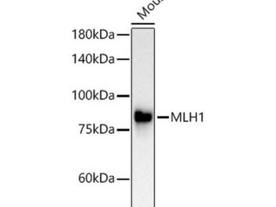 [KO Validated] MLH1 Rabbit mAb (A4858)