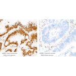 [KO Validated] MLH1 Rabbit mAb (Catalog Number: A4858) Abclonal