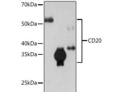 CD20 Rabbit mAb (A4893)