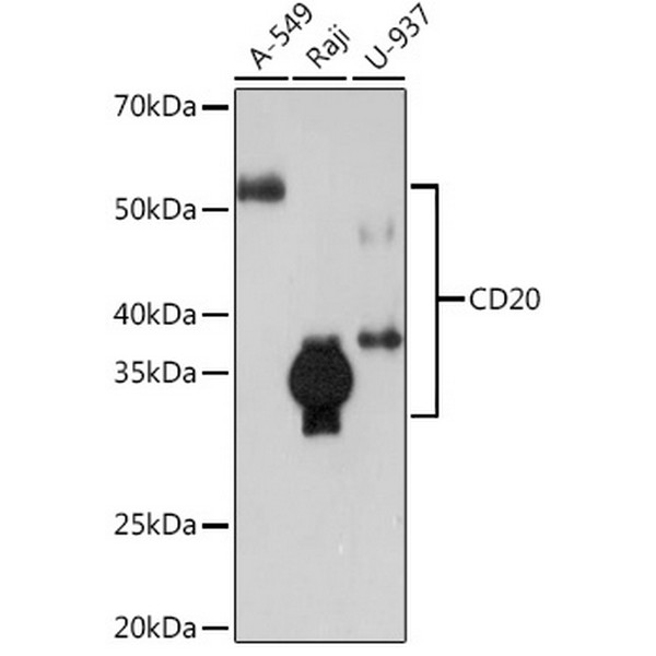 CD20 Rabbit mAb (A4893) CD20 Rabbit mAb (A4893)