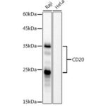 A4893: CD20 Rabbit mAb