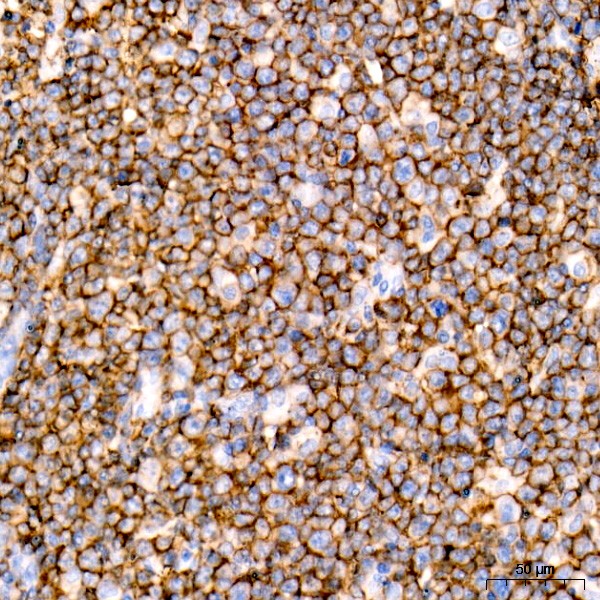 CD20 Rabbit mAb (Catalog Number: A4893) Abclonal