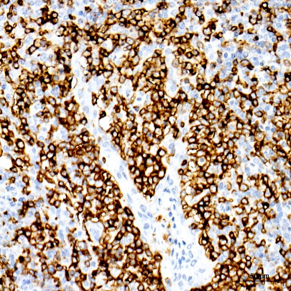 Abclonal CD20 Rabbit mAb (Catalog Number: A4893)