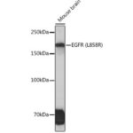 EGFR (L858R) Rabbit mAb (A5031)