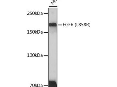 EGFR (L858R) Rabbit mAb (A5031)