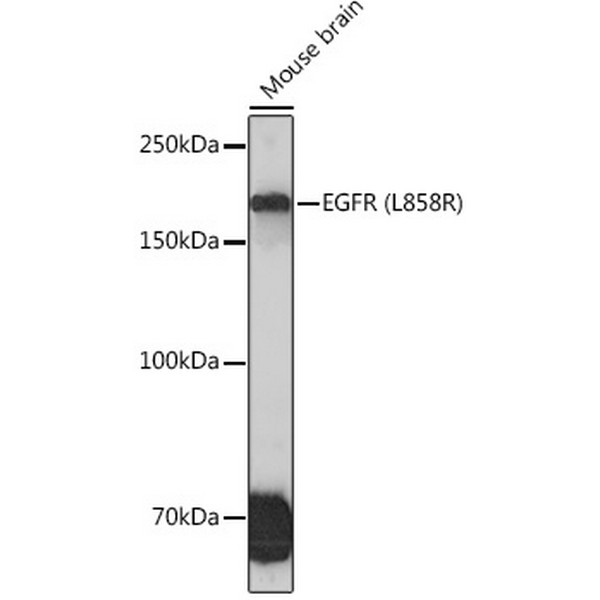 EGFR (L858R) Rabbit mAb (A5031) EGFR (L858R) Rabbit mAb (A5031)