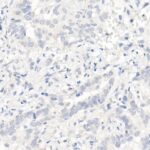 A5031: EGFR (L858R) Rabbit mAb