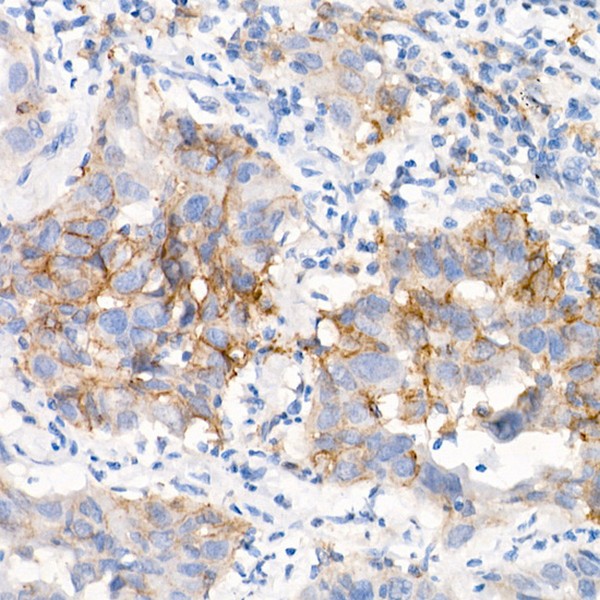EGFR (L858R) Rabbit mAb (Catalog Number: A5031) Abclonal