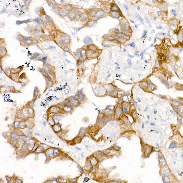 Abclonal EGFR (L858R) Rabbit mAb (Catalog Number: A5031)