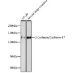 LI Cadherin/Cadherin-17 Rabbit mAb (A5286)