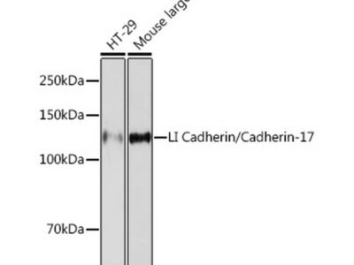 LI Cadherin/Cadherin-17 Rabbit mAb (A5286)