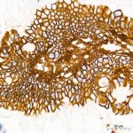 LI Cadherin/Cadherin-17 Rabbit mAb (Catalog Number: A5286) Abclonal