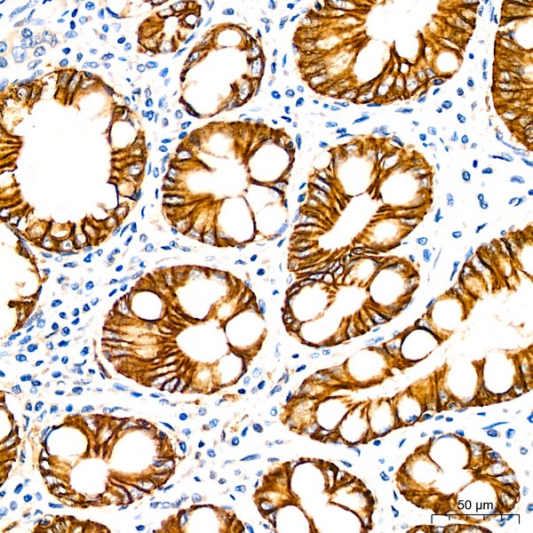 Abclonal LI Cadherin/Cadherin-17 Rabbit mAb (Catalog Number: A5286)