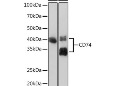 CD74 Rabbit mAb (A9149)