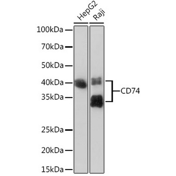 CD74 Rabbit mAb (A9149) CD74 Rabbit mAb (A9149)