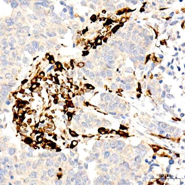 CD74 Rabbit mAb (Catalog Number: A9149) Abclonal