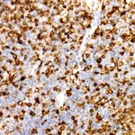 Abclonal CD74 Rabbit mAb (Catalog Number: A9149)