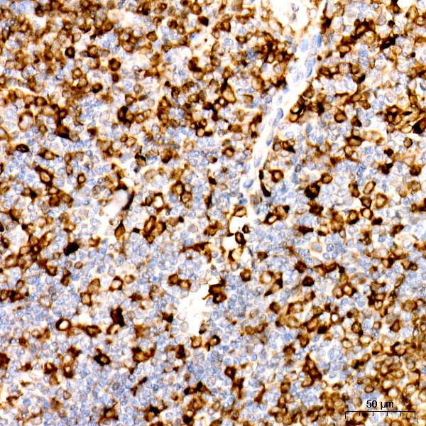 Abclonal CD74 Rabbit mAb (Catalog Number: A9149)