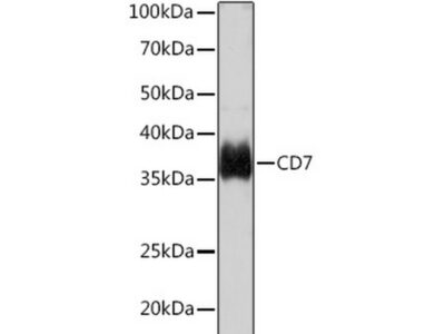 CD7 Rabbit mAb (A9560)
