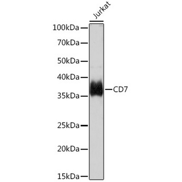 CD7 Rabbit mAb (A9560) CD7 Rabbit mAb (A9560)