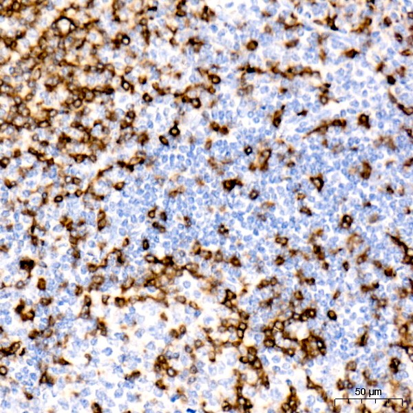 CD7 Rabbit mAb (Catalog Number: A9560) Abclonal