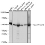 Fascin/FSCN1 Rabbit mAb (A9566)