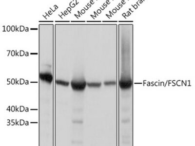 Fascin/FSCN1 Rabbit mAb (A9566)