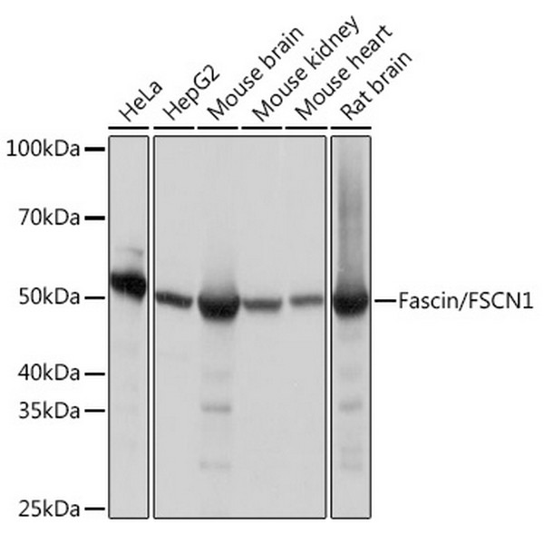 Fascin/FSCN1 Rabbit mAb (A9566) Fascin/FSCN1 Rabbit mAb (A9566)