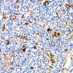 A9566: Fascin/FSCN1 Rabbit mAb