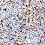 Abclonal Fascin/FSCN1 Rabbit mAb (Catalog Number: A9566)