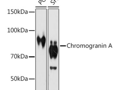 Chromogranin A Rabbit mAb (A9576)