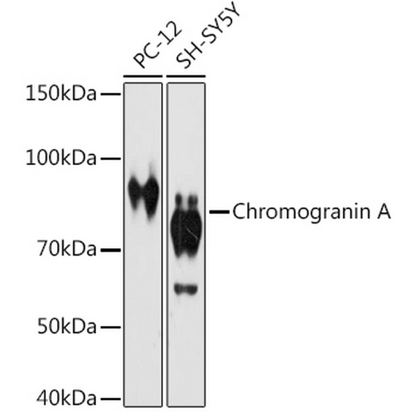 Chromogranin A Rabbit mAb (A9576)