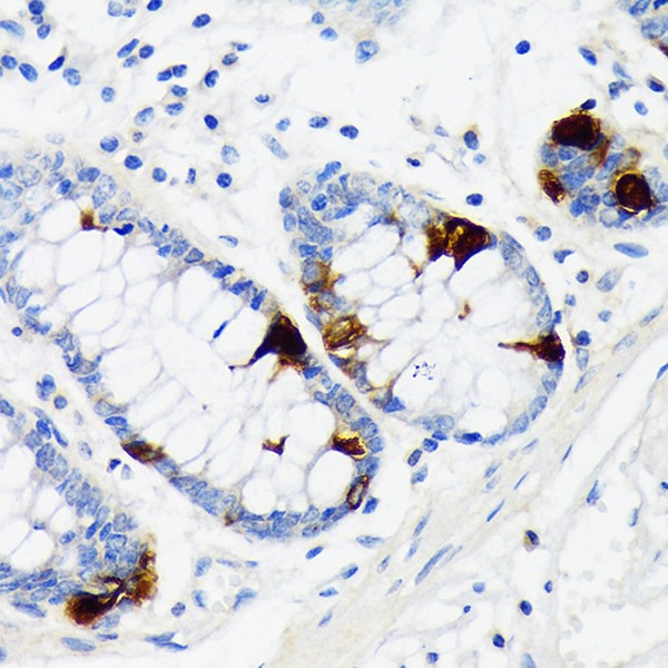 Chromogranin A Rabbit mAb (Catalog Number: A9576) Abclonal