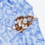 Abclonal Chromogranin A Rabbit mAb (Catalog Number: A9576)
